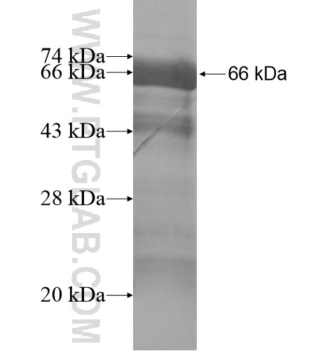 TMEM79 fusion protein Ag14803 SDS-PAGE TMEM79 fusion protein Ag14803 SDS-PAGE