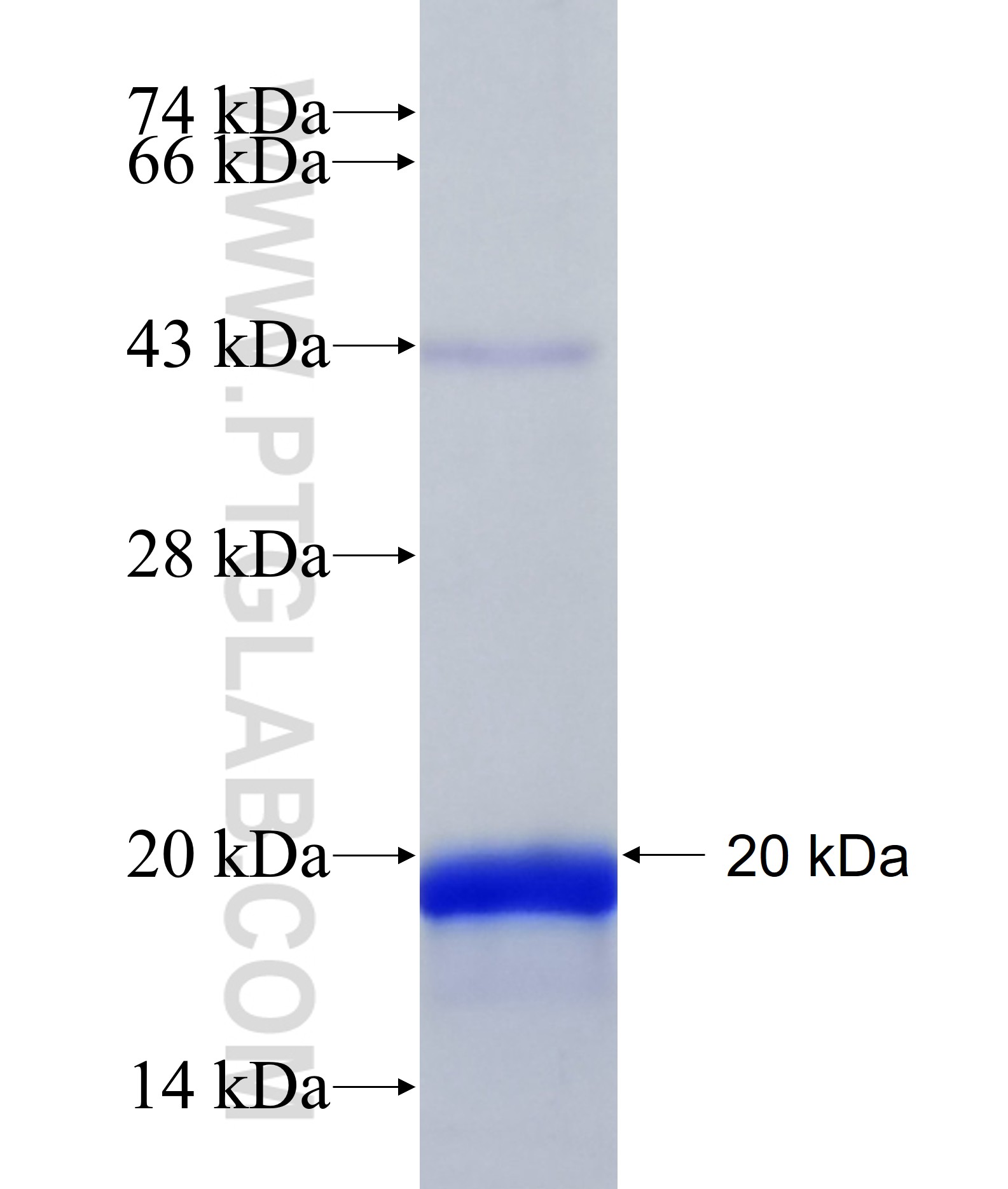 TMEM80 fusion protein Ag41271 SDS-PAGE TMEM80 fusion protein Ag41271 SDS-PAGE