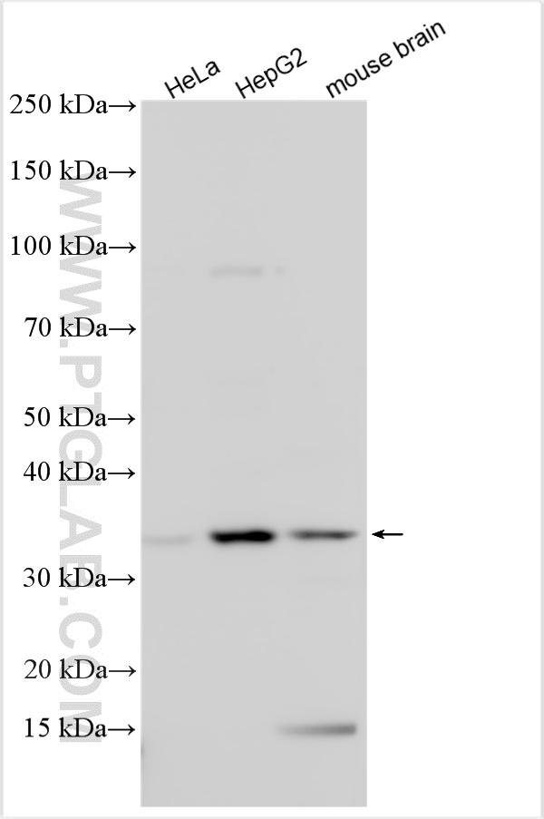 WB analysis using 25634-1-AP