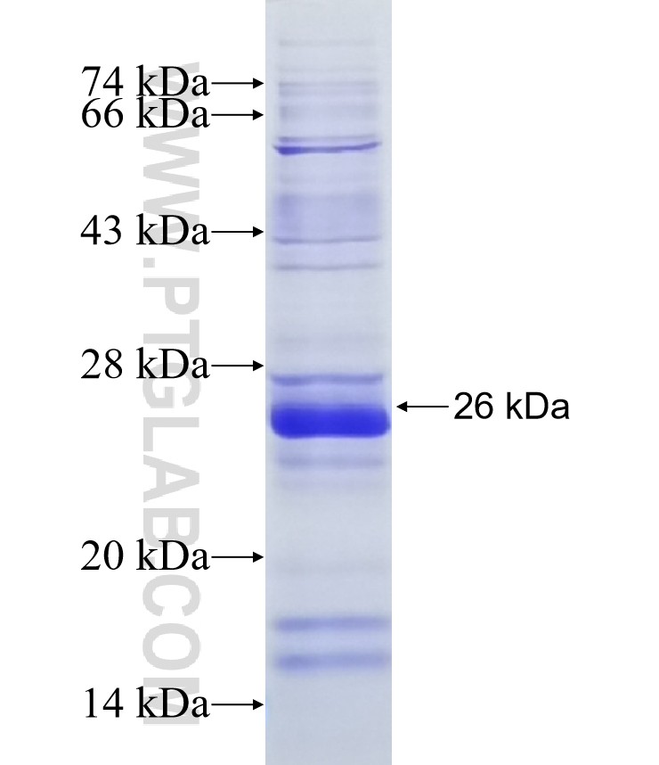 TMEM81 fusion protein Ag22367 SDS-PAGE