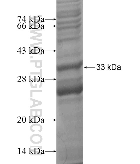 TMEM82 fusion protein Ag19636 SDS-PAGE TMEM82 fusion protein Ag19636 SDS-PAGE