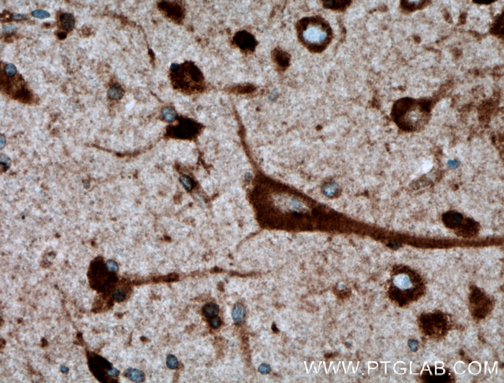 IHC staining of human brain using 27708-1-AP