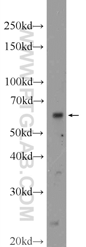 WB analysis of MDA-MB-453s using 25091-1-AP