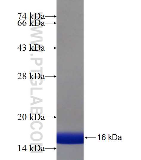 TMEM87A fusion protein Ag19117 SDS-PAGE TMEM87A fusion protein Ag19117 SDS-PAGE