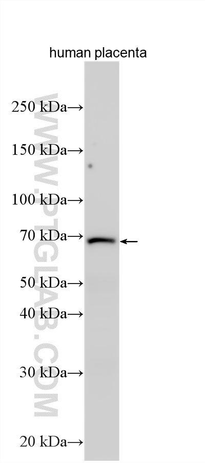 WB analysis using 21889-1-AP