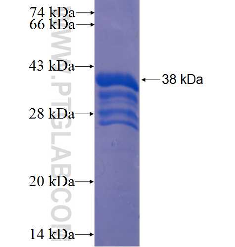 TMEM93 fusion protein Ag23114 SDS-PAGE
