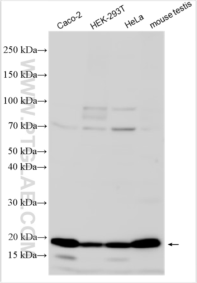 Various lysates were subjected to SDS PAGE followed by western blot with 26444-1-AP (TMEM97 antibody) at dilution of 1:1000 incubated at room temperature for 1.5 hours. WB analysis using 26444-1-AP
