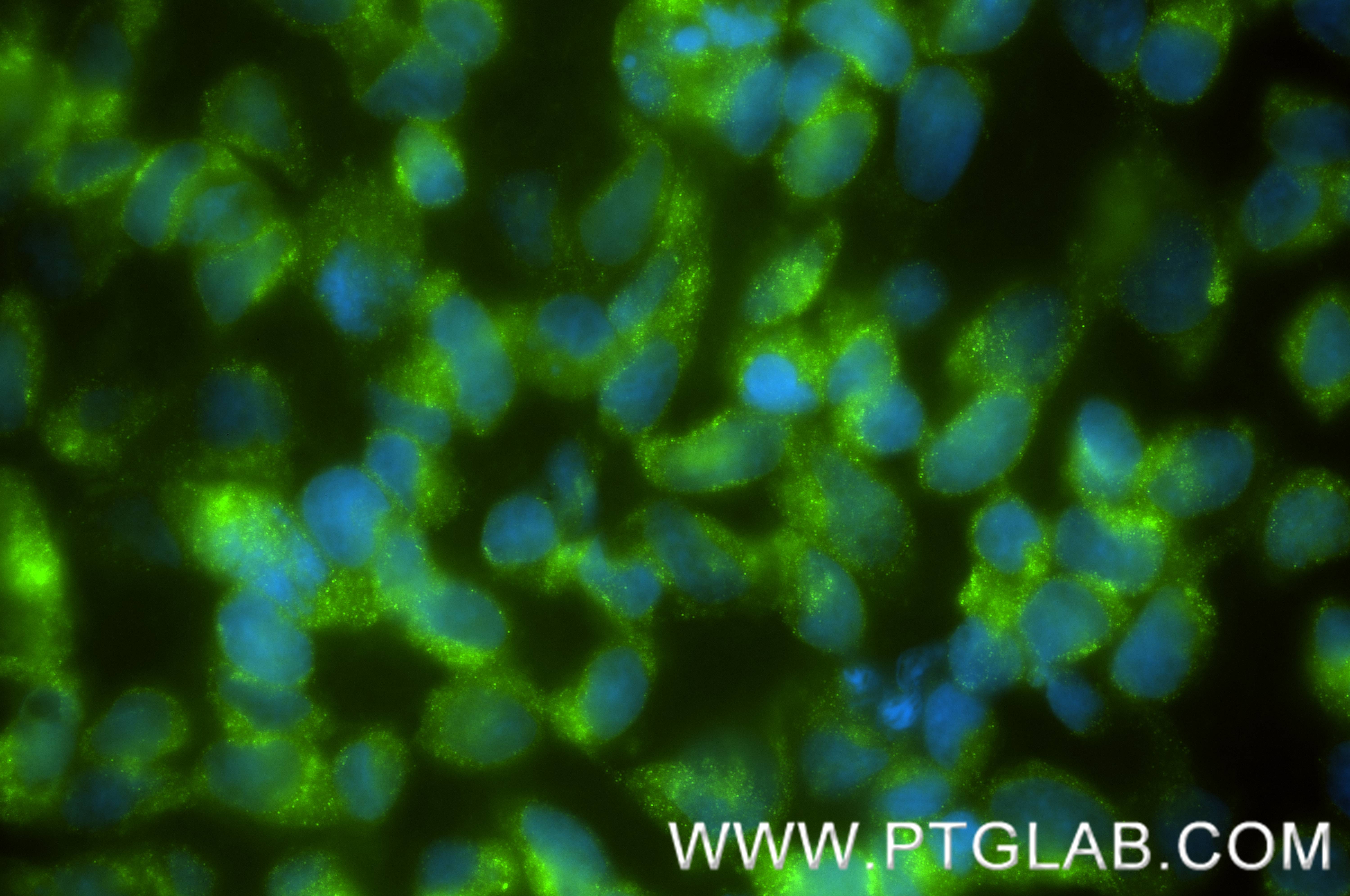 IF Staining of Caco-2 using 86837-1-RR (same clone as 86837-1-PBS) IF Staining of Caco-2 using 86837-1-RR (same clone as 86837-1-PBS)