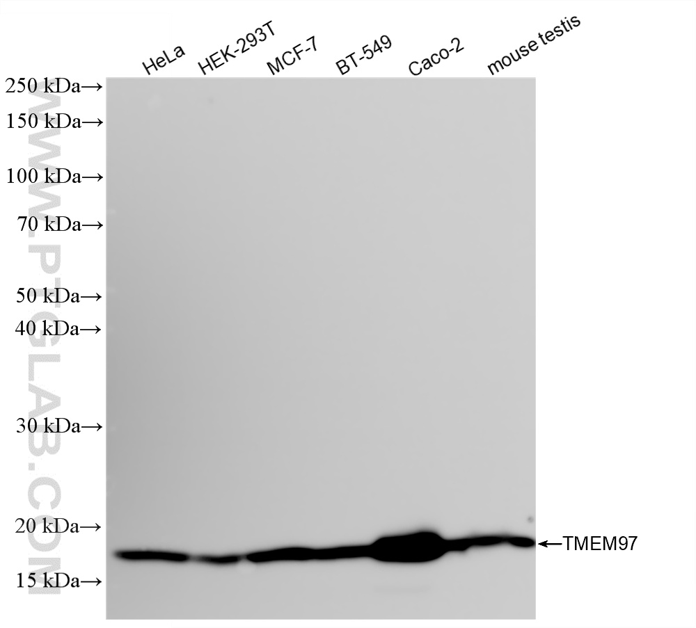 WB analysis using 86837-1-RR (same clone as 86837-1-PBS) WB analysis using 86837-1-RR (same clone as 86837-1-PBS)