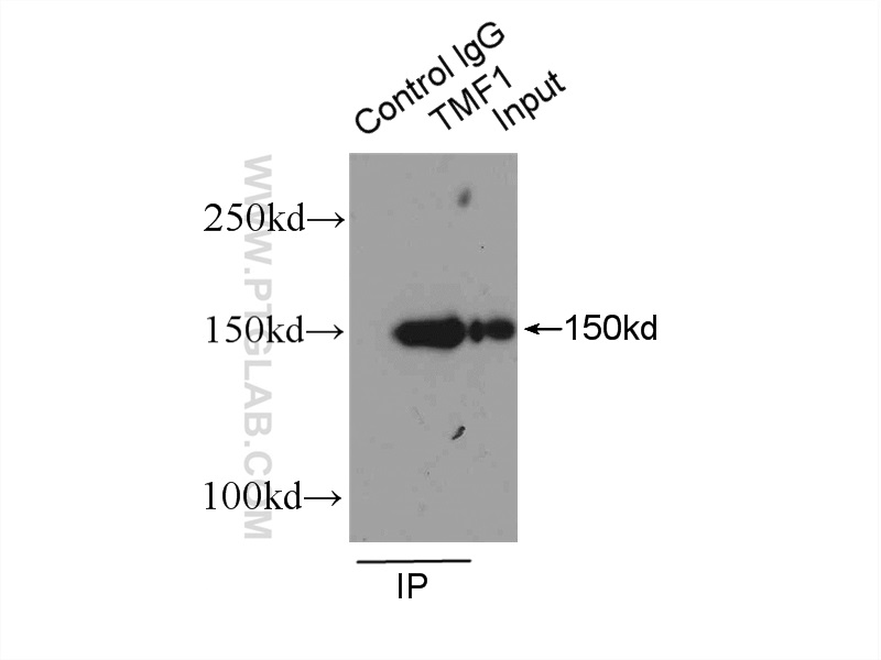 IP experiment of HepG2 using 19728-1-AP