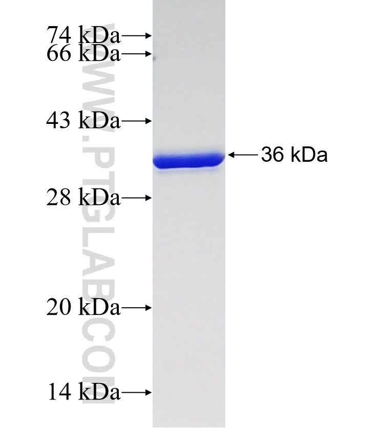 TMIE fusion protein Ag22110 SDS-PAGE TMIE fusion protein Ag22110 SDS-PAGE