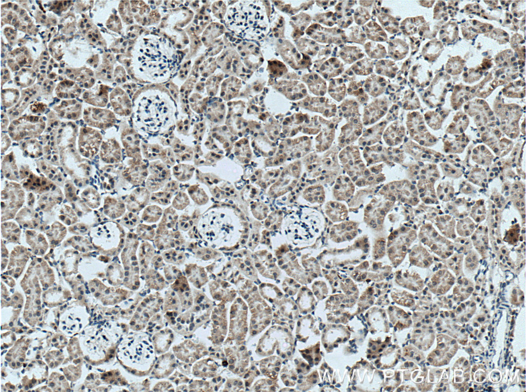 IHC staining of mouse kidney using 27174-1-AP (same clone as 27174-1-PBS)