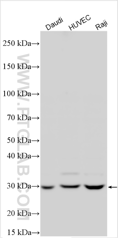 WB analysis using 27174-1-AP (same clone as 27174-1-PBS)
