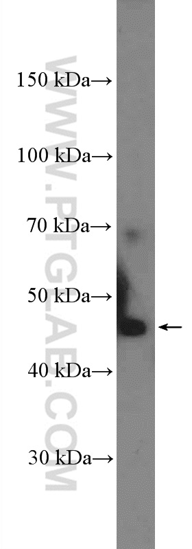 WB analysis of mouse kidney using 27174-1-AP (same clone as 27174-1-PBS)
