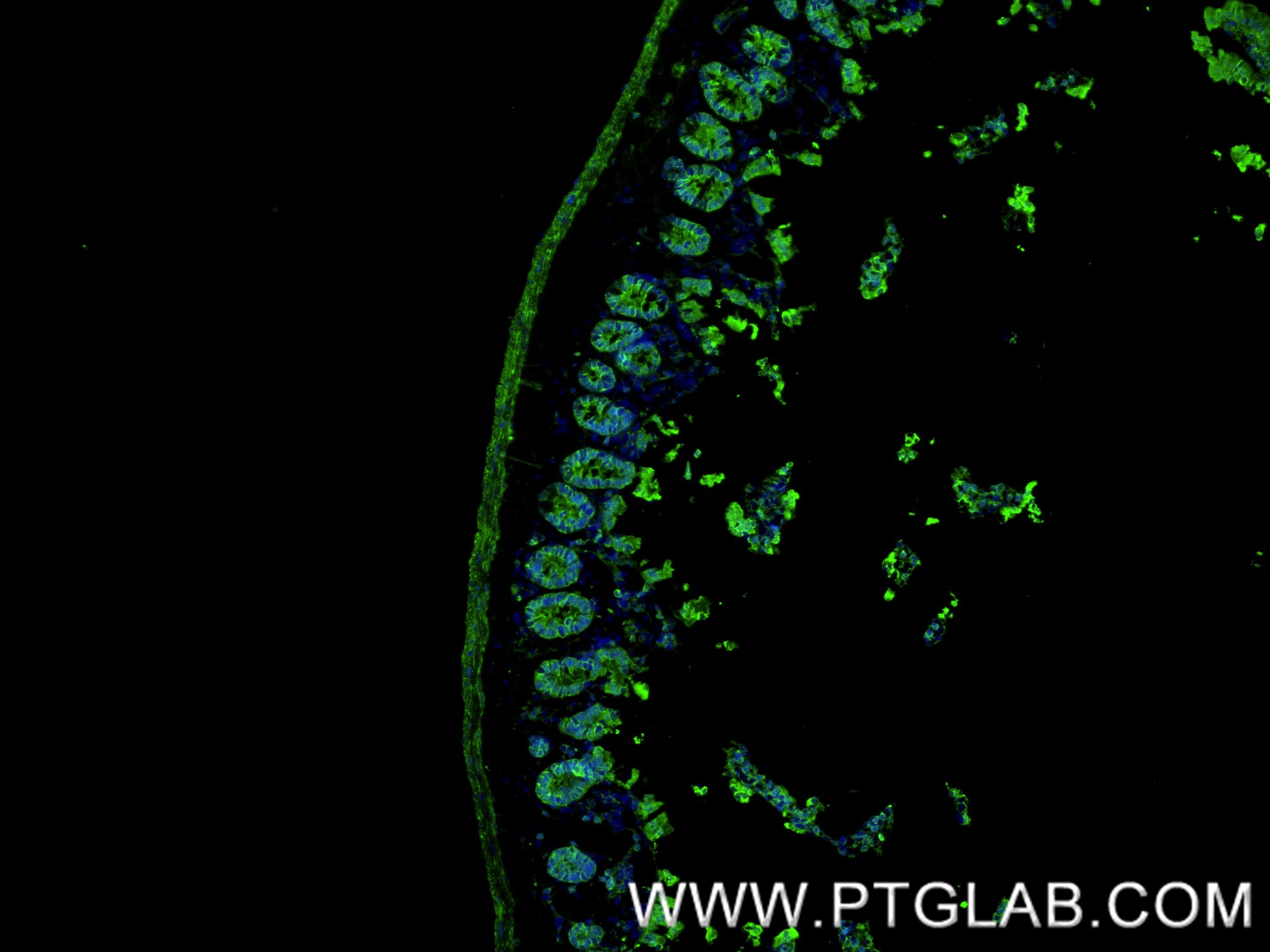 IF Staining of mouse small intestine using 84130-6-RR (same clone as 84130-6-PBS) IF Staining of mouse small intestine using 84130-6-RR (same clone as 84130-6-PBS)
