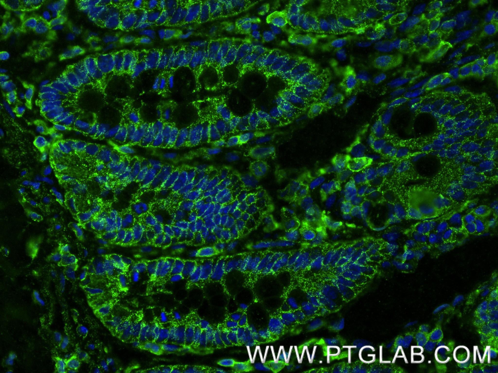 IF Staining of rat small intestine using 84130-6-RR (same clone as 84130-6-PBS) IF Staining of rat small intestine using 84130-6-RR (same clone as 84130-6-PBS)