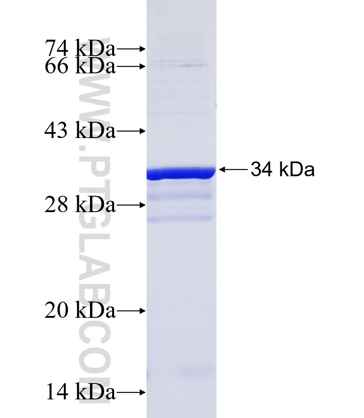 TMIGD1 fusion protein Ag25691 SDS-PAGE