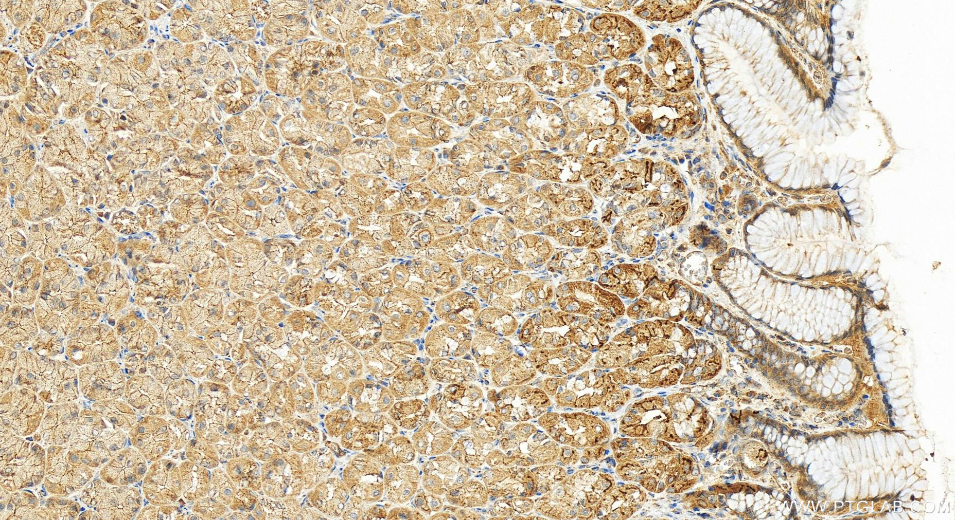 IHC staining of human stomach using 16621-1-AP