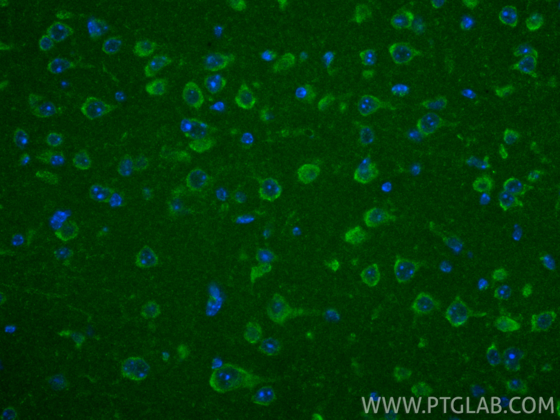 IF Staining of mouse brain using 16621-1-AP IF Staining of mouse brain using 16621-1-AP