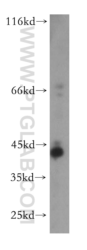 WB analysis of human liver using 16621-1-AP