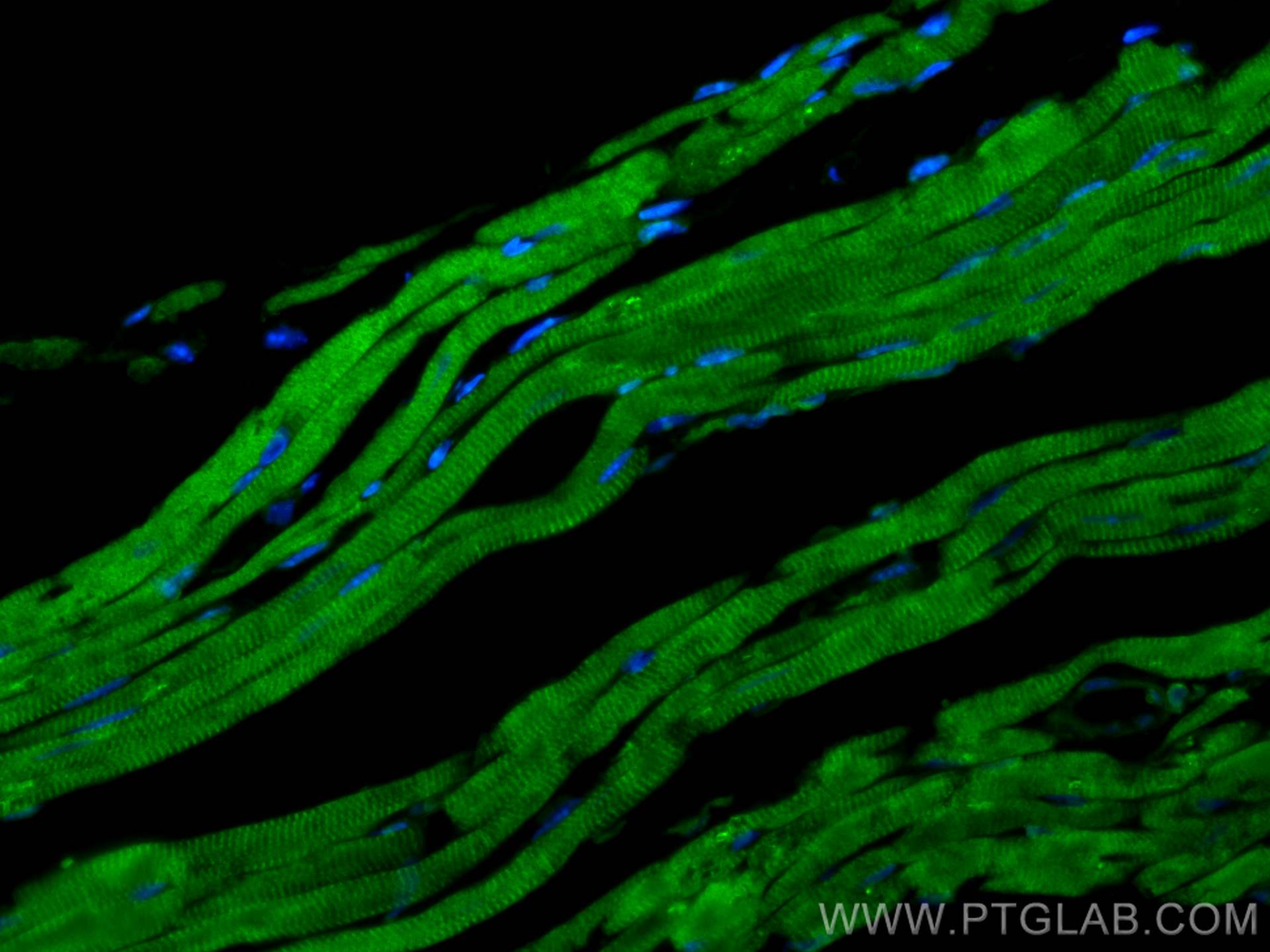 IF Staining of mouse heart using 10145-1-AP