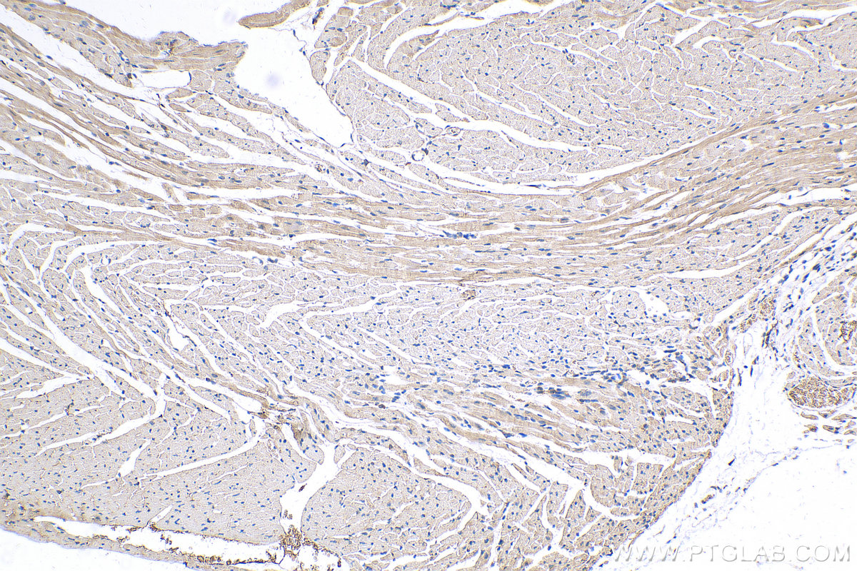 IHC staining of mouse heart using 10145-1-AP