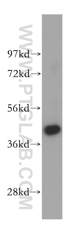 WB analysis of human testis using 15262-1-AP