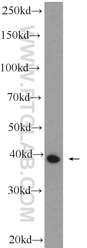 WB analysis of mouse skeletal muscle using 11753-1-AP