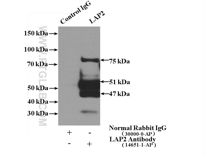 IP experiment of HeLa using 14651-1-AP