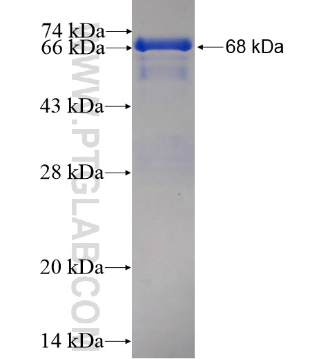 TMPO fusion protein Ag6247 SDS-PAGE