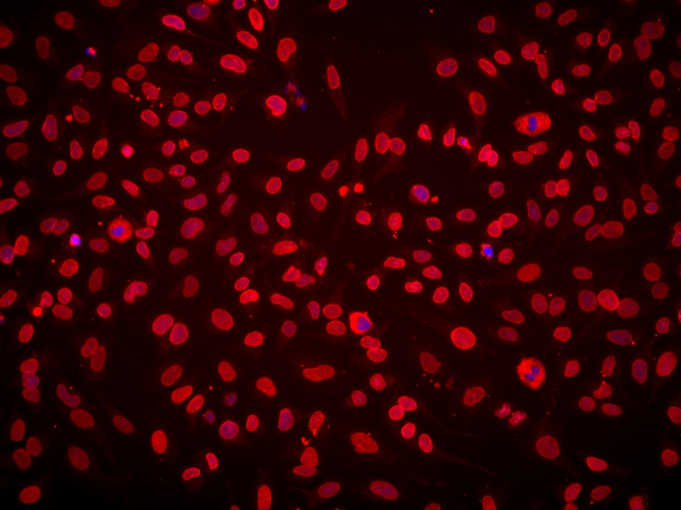 IF Staining of HeLa using 67157-1-Ig (same clone as 67157-1-PBS)