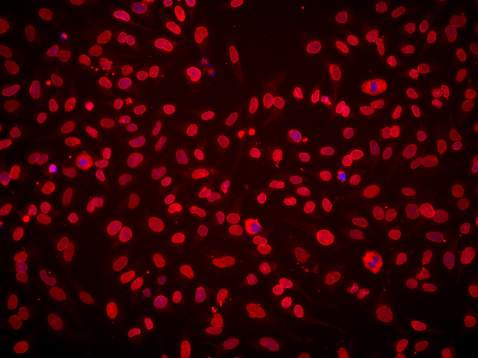 IF Staining of HeLa using 67157-1-Ig