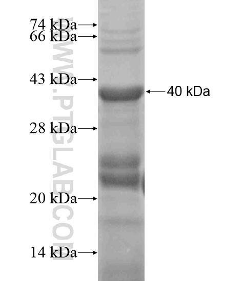 TMPRSS11D fusion protein Ag19061 SDS-PAGE TMPRSS11D fusion protein Ag19061 SDS-PAGE