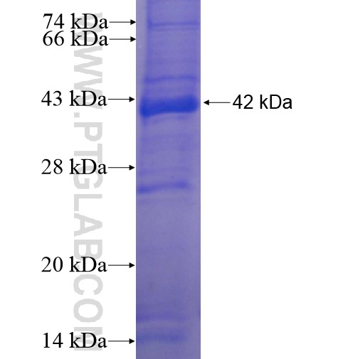 TMPRSS12 fusion protein Ag14777 SDS-PAGE TMPRSS12 fusion protein Ag14777 SDS-PAGE