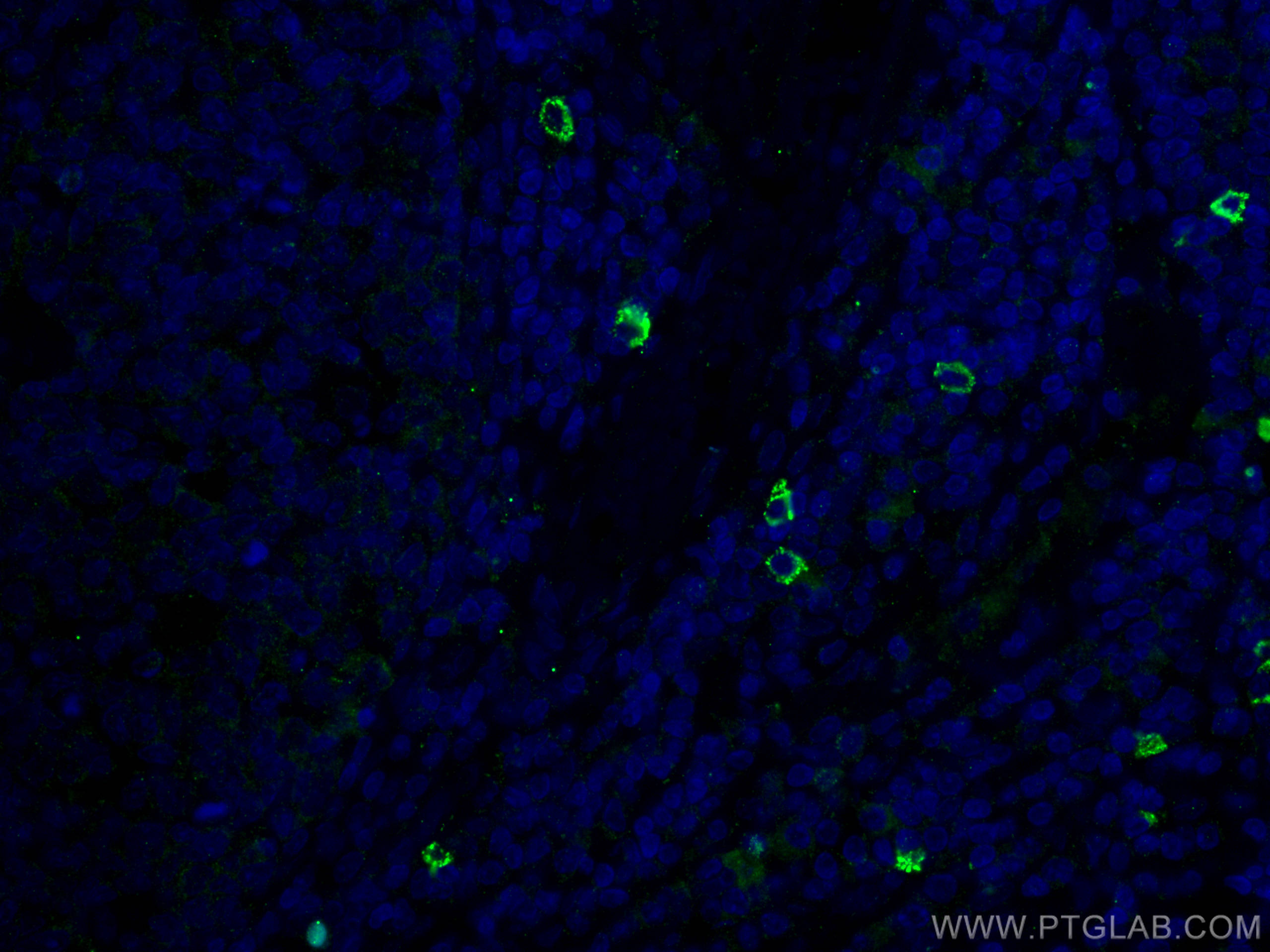 IF Staining of human tonsillitis using 14437-1-AP