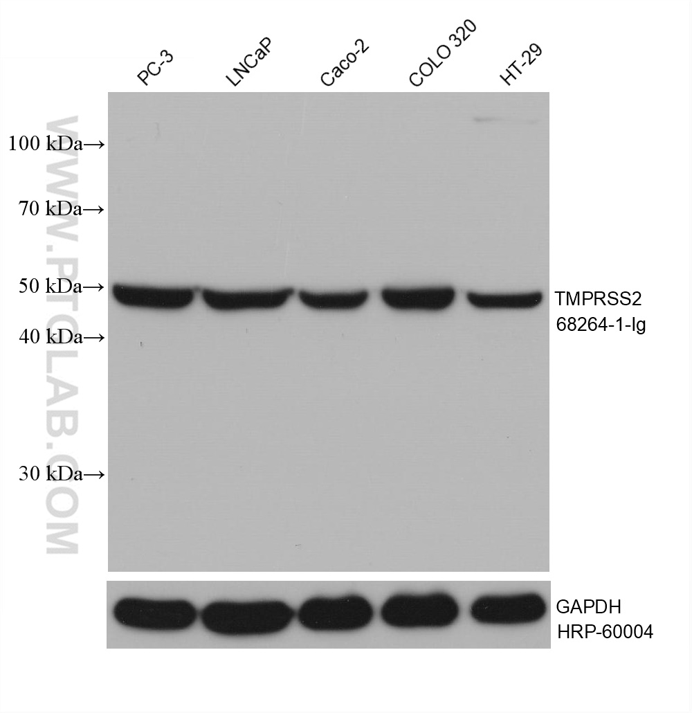 WB analysis using 68264-1-Ig