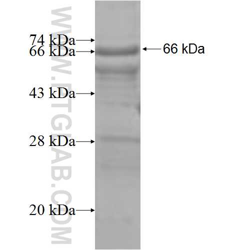 TMPRSS2 fusion protein Ag6452 SDS-PAGE