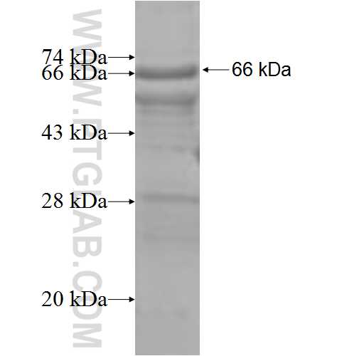 TMPRSS2 fusion protein Ag6452 SDS-PAGE TMPRSS2 fusion protein Ag6452 SDS-PAGE