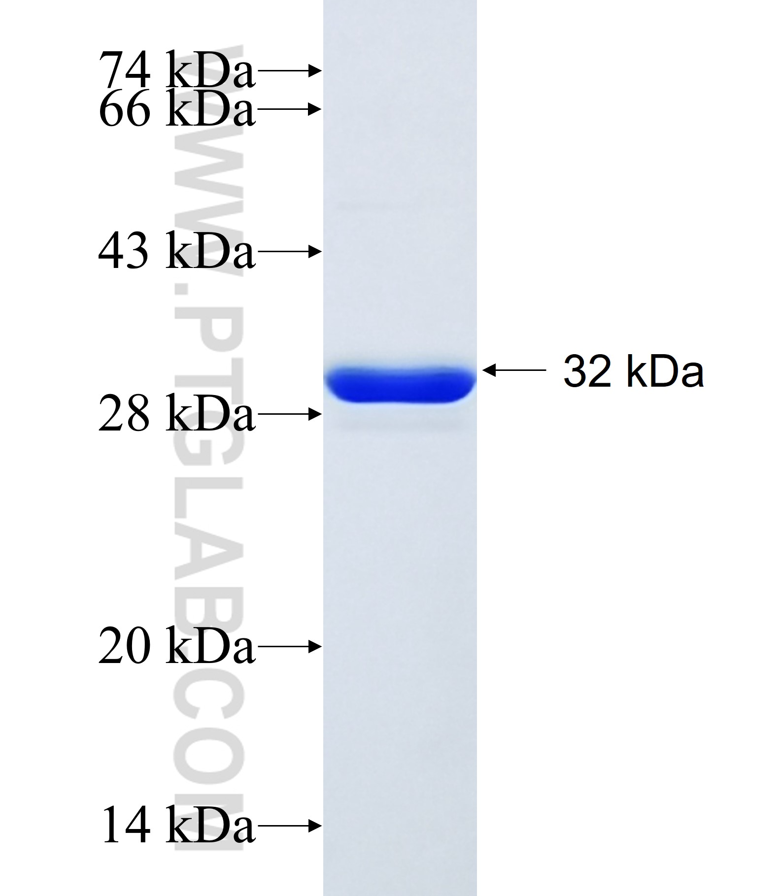 TMSB10 fusion protein Ag34308 SDS-PAGE TMSB10 fusion protein Ag34308 SDS-PAGE