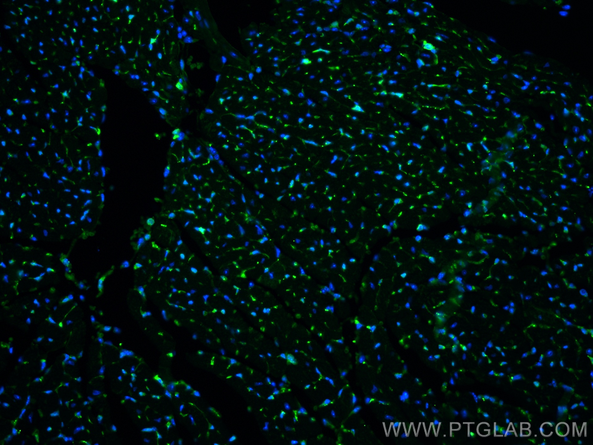 IF Staining of mouse heart using 19850-1-AP