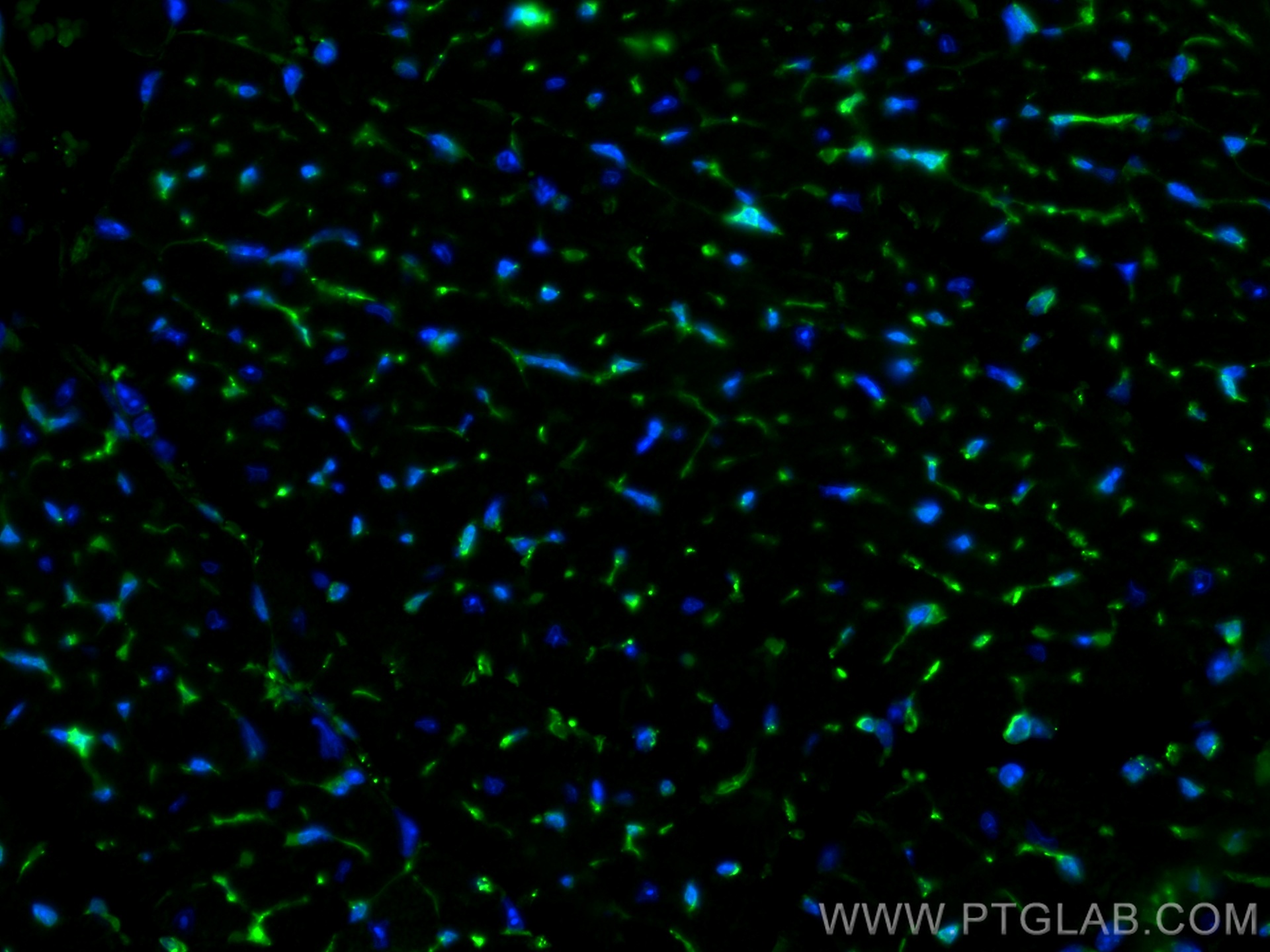 IF Staining of mouse heart using 19850-1-AP