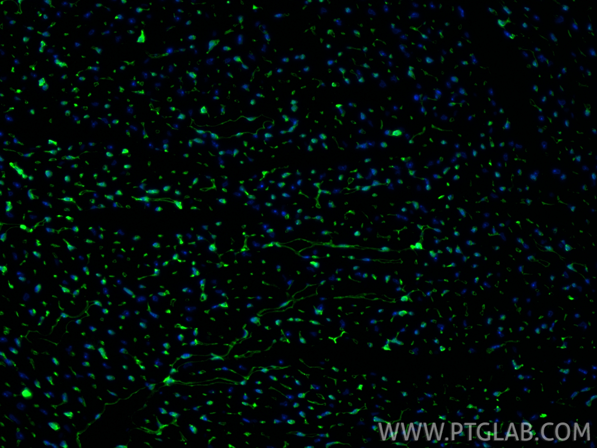 IF Staining of mouse heart using 19850-1-AP