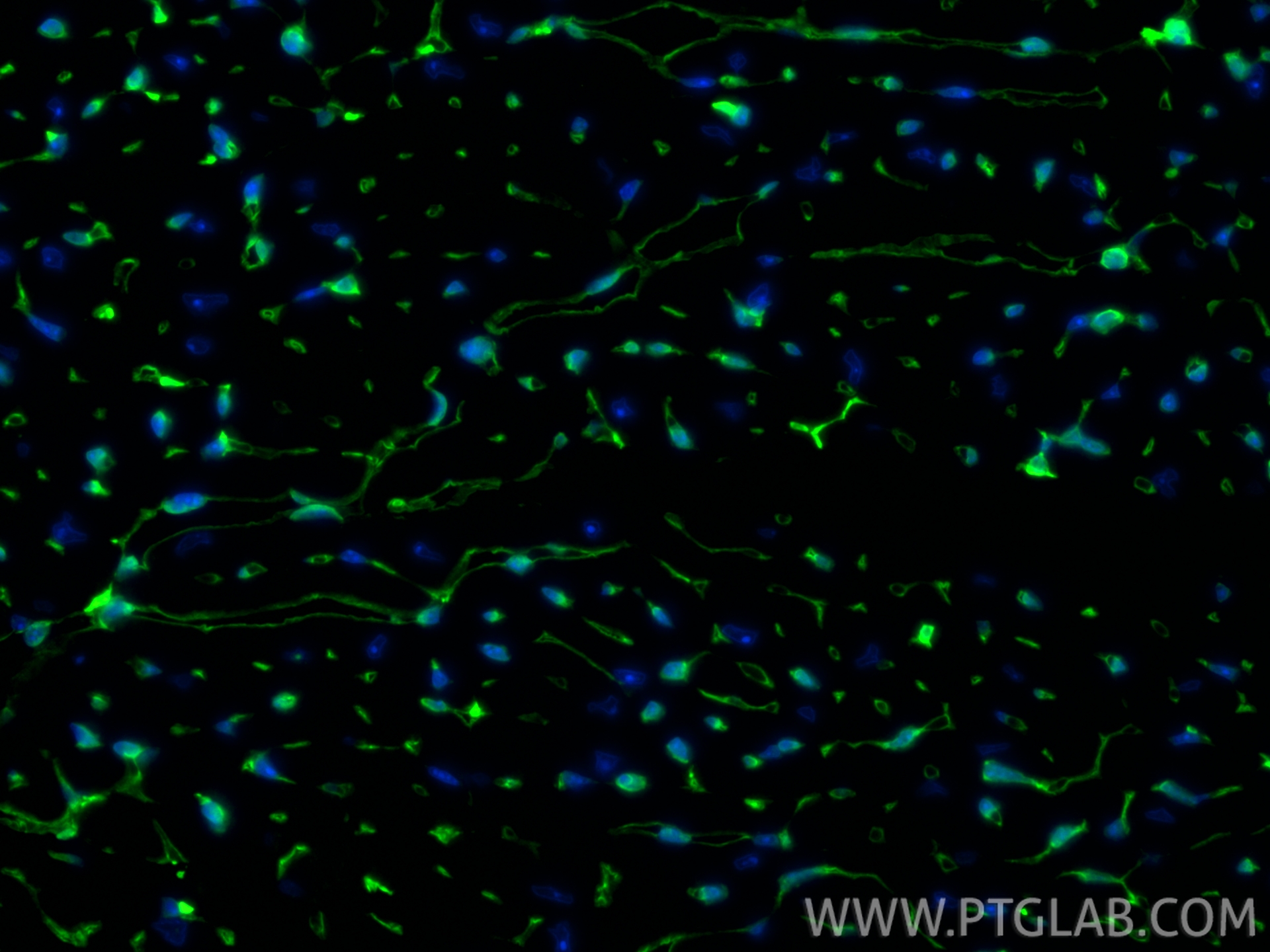 IF Staining of mouse heart using 19850-1-AP