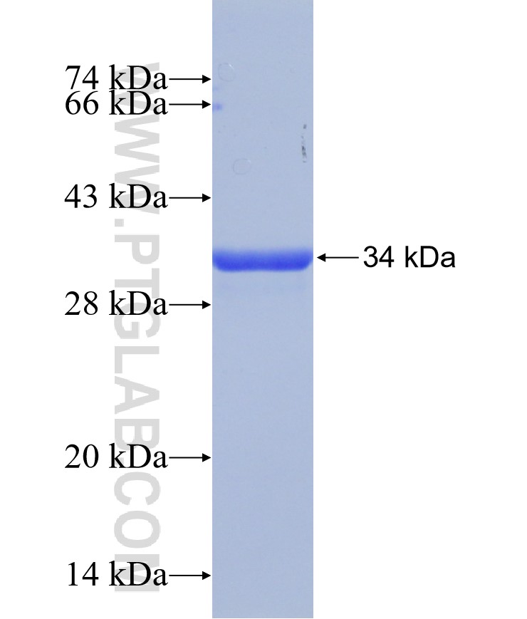 TMSB4X fusion protein Ag31508 SDS-PAGE