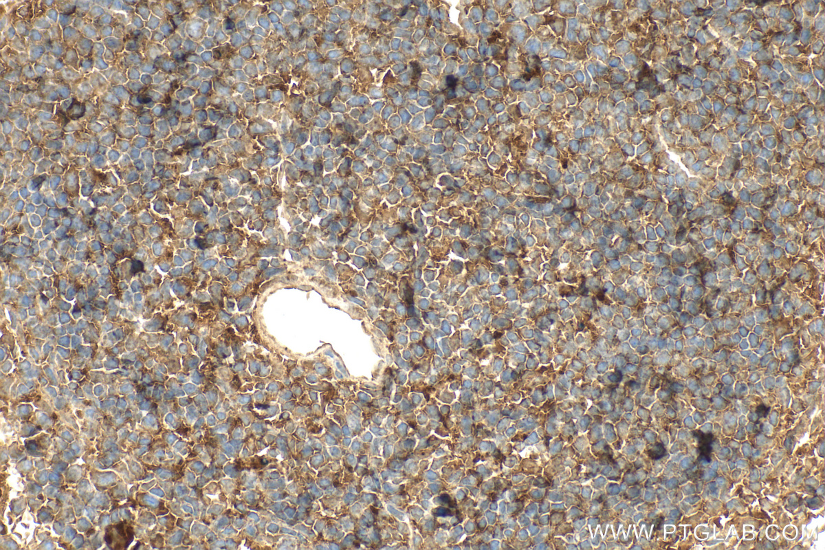 Immunohistochemical analysis of paraffin-embedded mouse spleen tissue slide using 23349-1-AP (TMTC1 antibody) at dilution of 1:200 (under 40x lens). Heat mediated antigen retrieval with Tris-EDTA buffer (pH 9.0). IHC staining of mouse spleen using 23349-1-AP