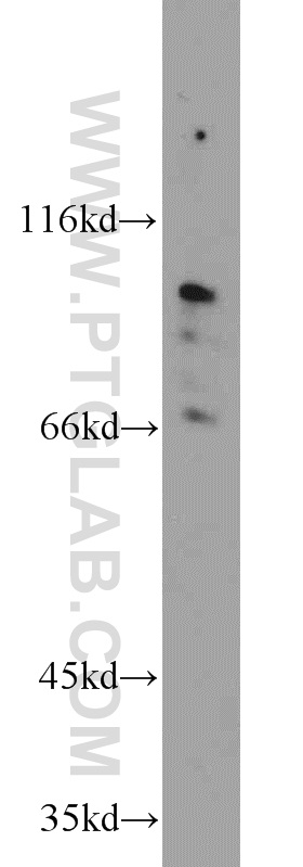 WB analysis of mouse bladder using 23349-1-AP