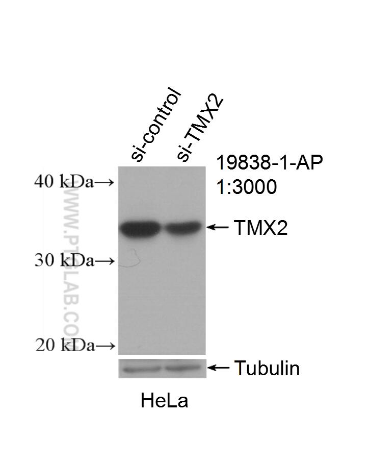 WB analysis of HeLa using 19838-1-AP