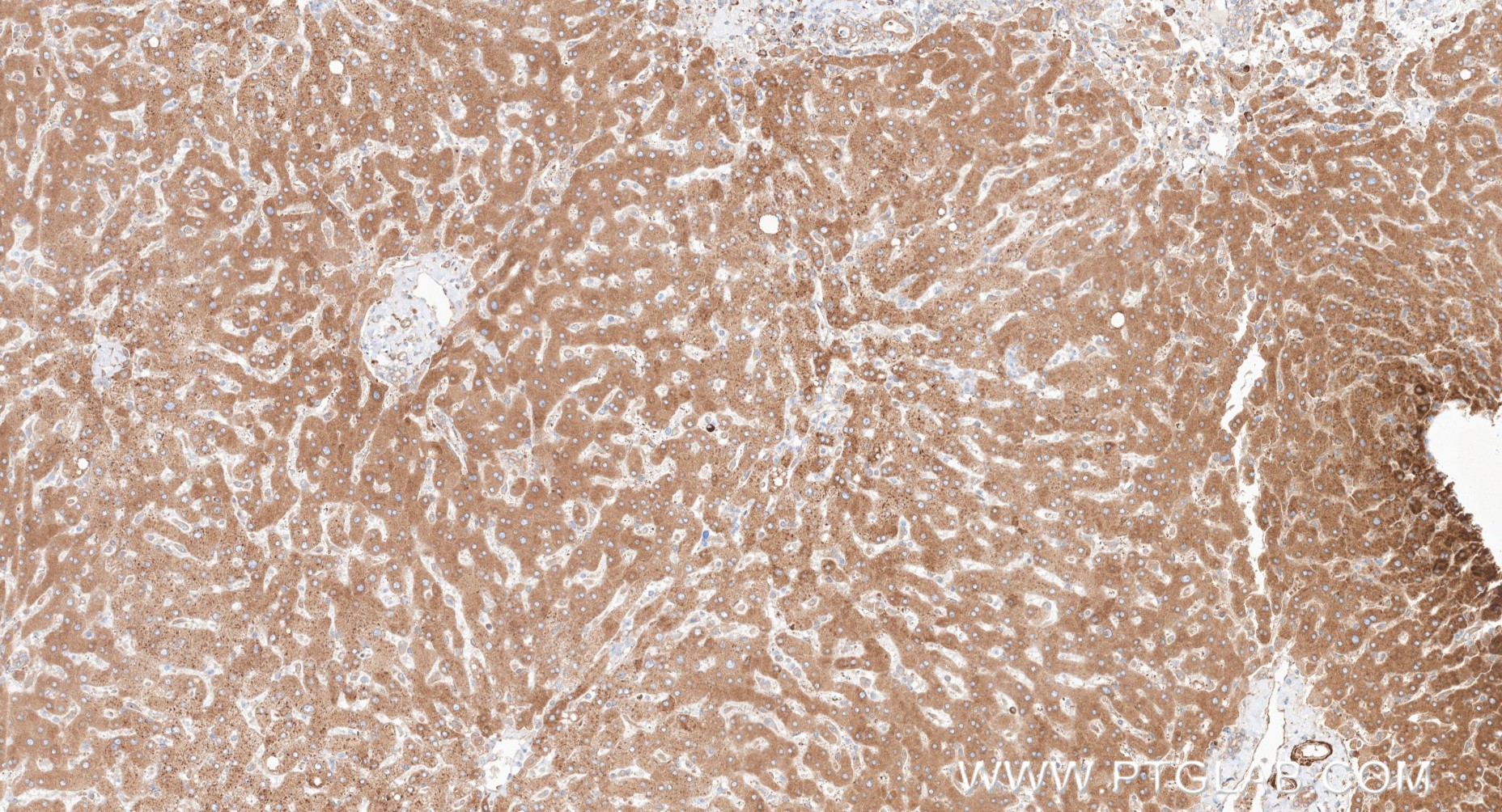 IHC staining of human liver using 87183-1-RR (same clone as 87183-1-PBS)