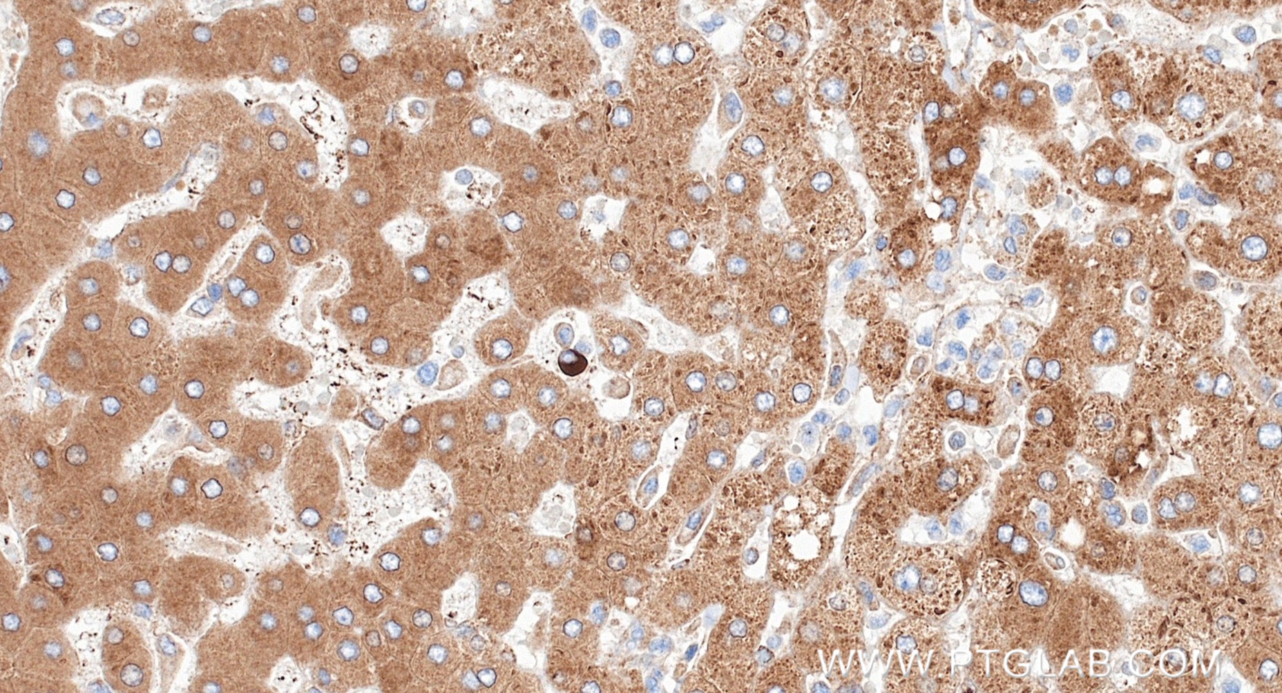 IHC staining of human liver using 87183-1-RR (same clone as 87183-1-PBS)