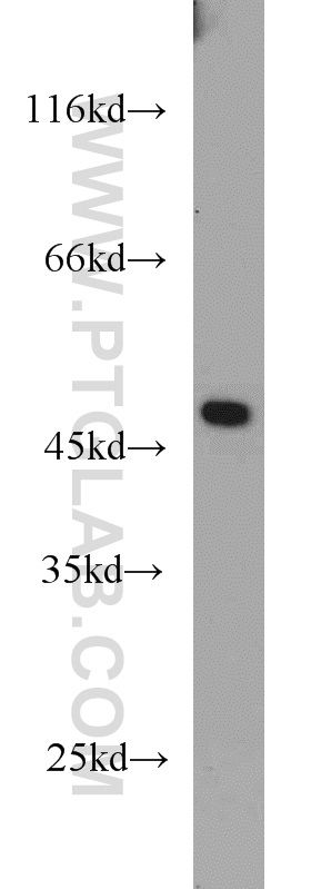 WB analysis of mouse brain using 21348-1-AP